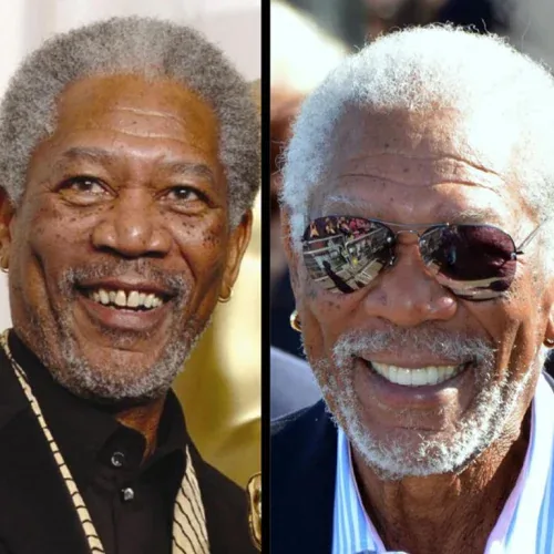 Morgan Freeman Smile Transformation with Dental Implants
