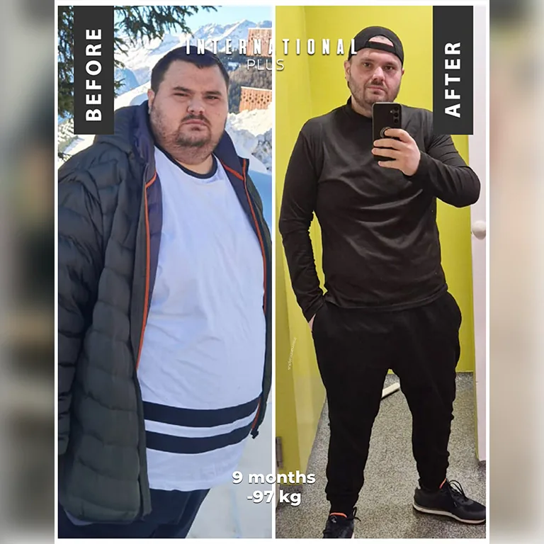 Treating Obesity