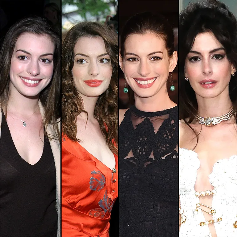 Anne Hathaway Botox