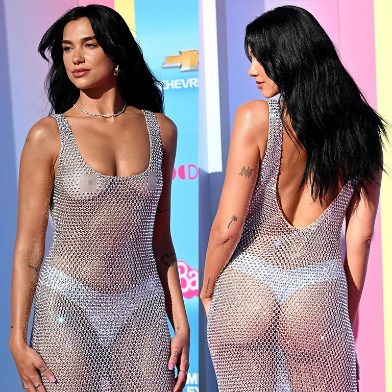 Dua Lipa Fillers