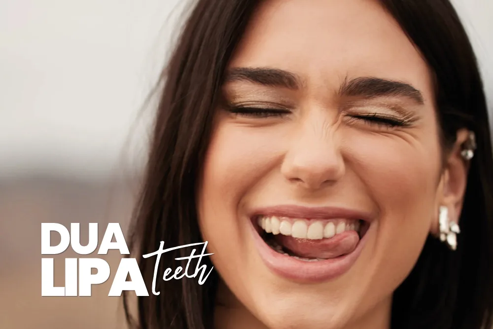 Dua Lipa Teeth