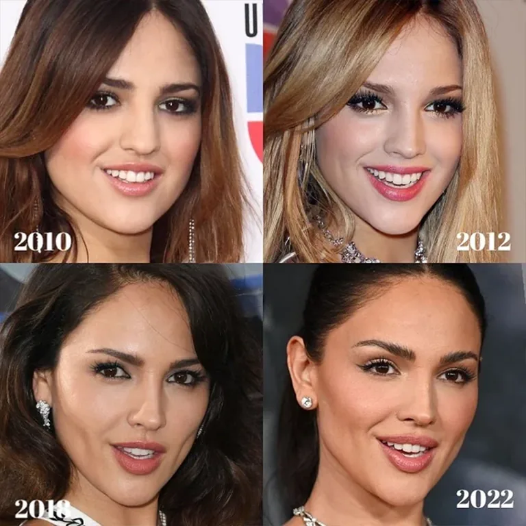 Eiza González Before and After