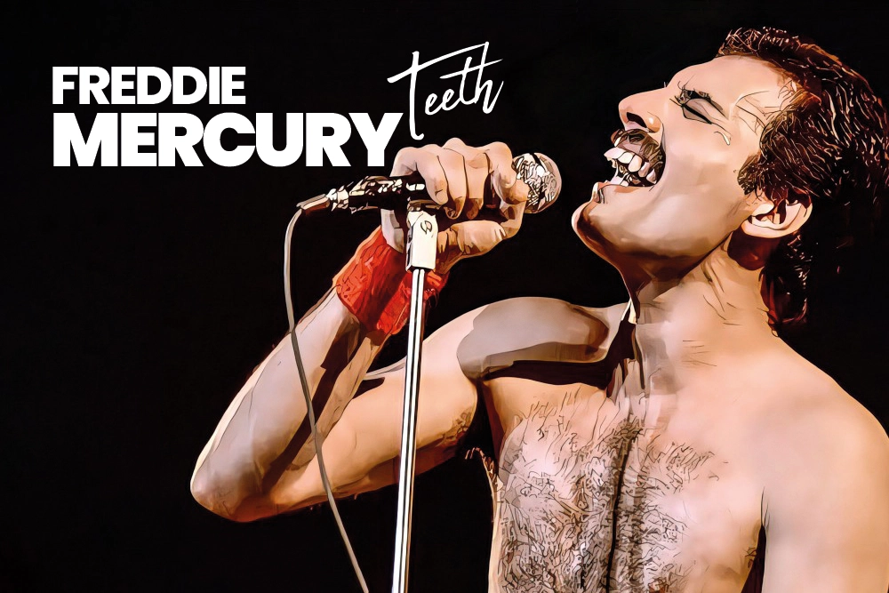 Freddie Mercury Teeth
