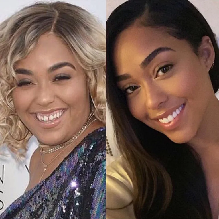 Jordyn Woods Cosmetic Dentistry