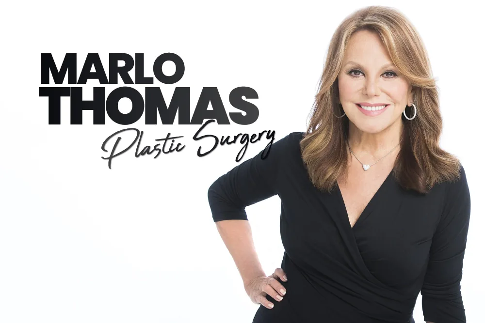 Marlo Thomas Plastic Surgery