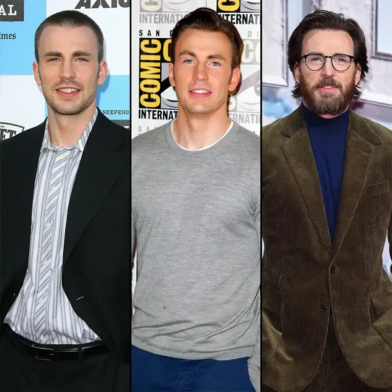 Chris Evans Hair Restoration Journey