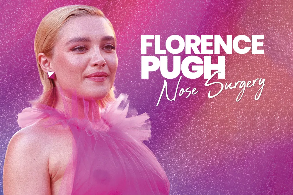 Florence Pugh Nose Surgery