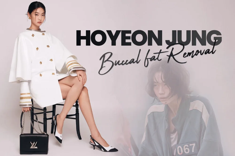HoYeon Jung Buccal Fat Removal