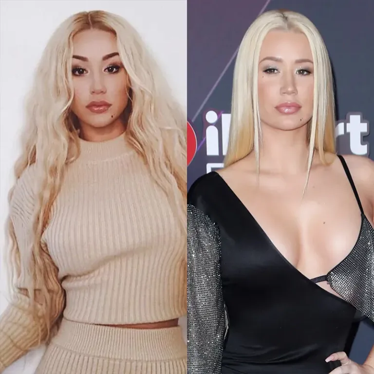 Iggy Azalea Brazilian Butt Lift Before and After