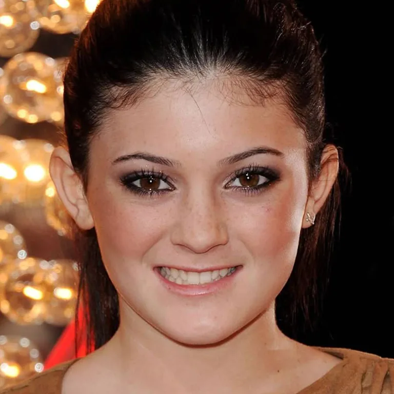 Kylie Jenner Porcelain Veneers