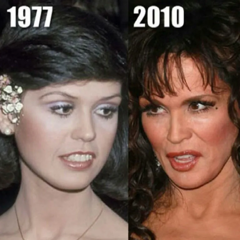 Marie Osmond Beauty Evolution
