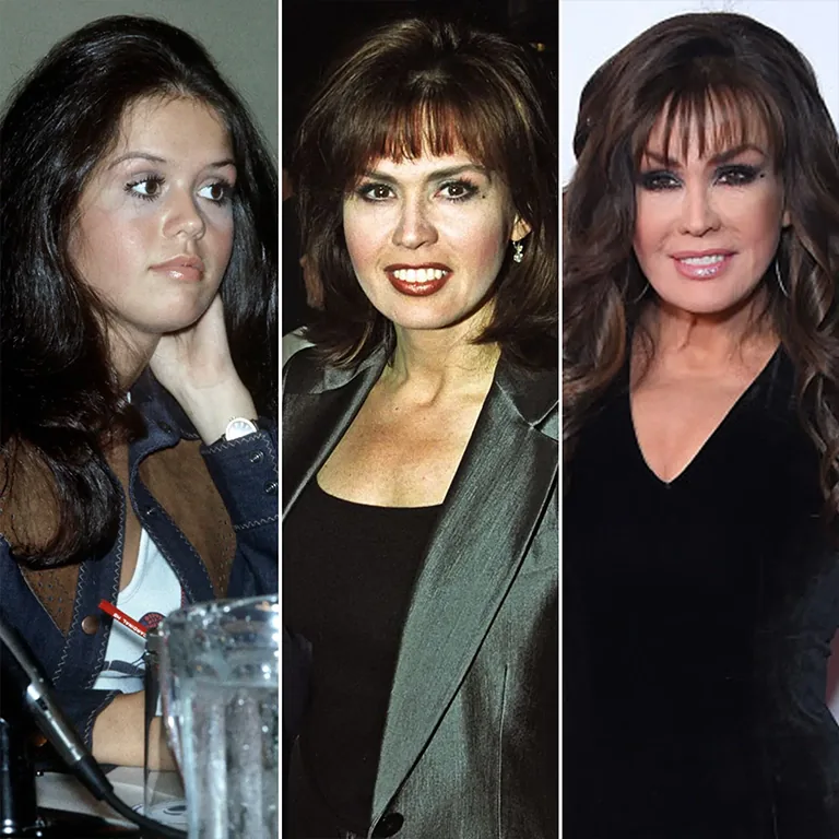 Marie Osmond Facelift Before and After