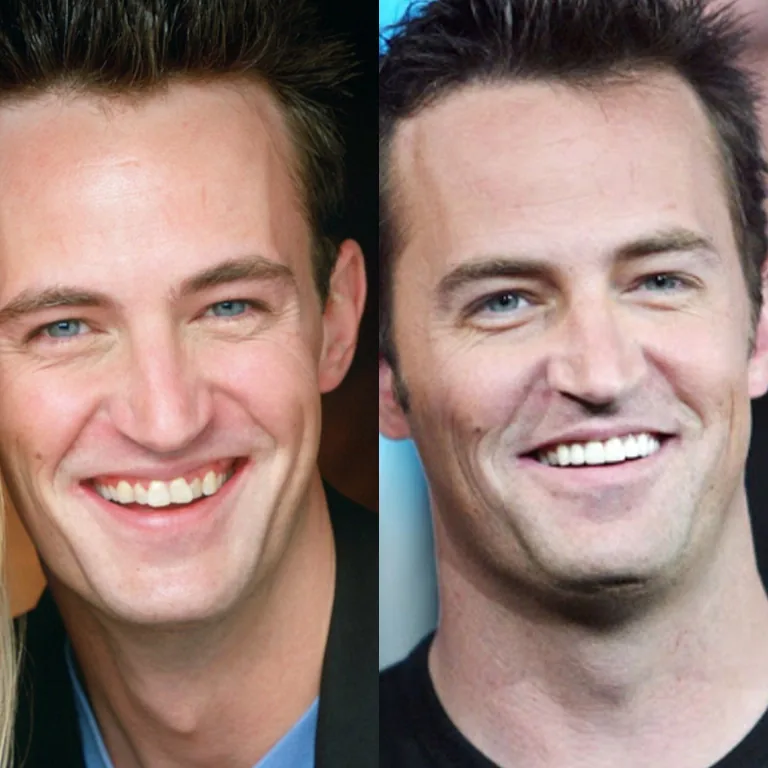 Matthew Perry Hollywood Smile