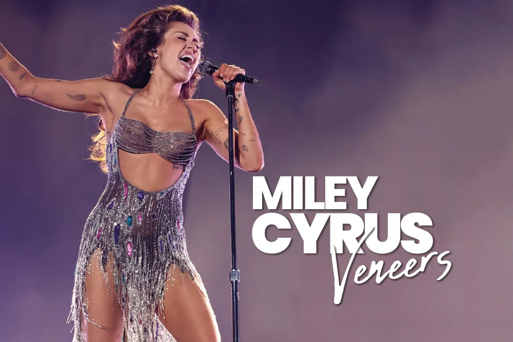Miley Cyrus Veneers