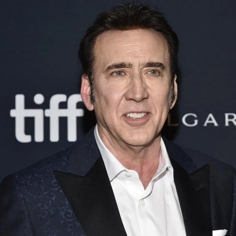 Nicolas Cage Porcelain Veneers