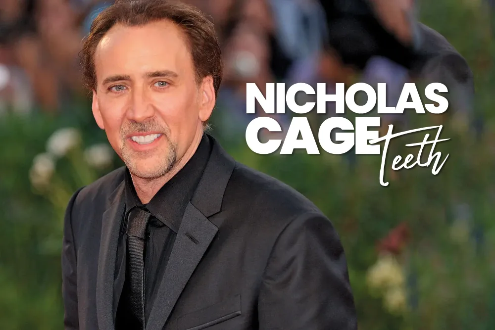 Nicolas Cage Teeth