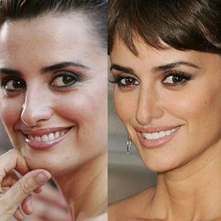 Penelope Cruz Nose Job