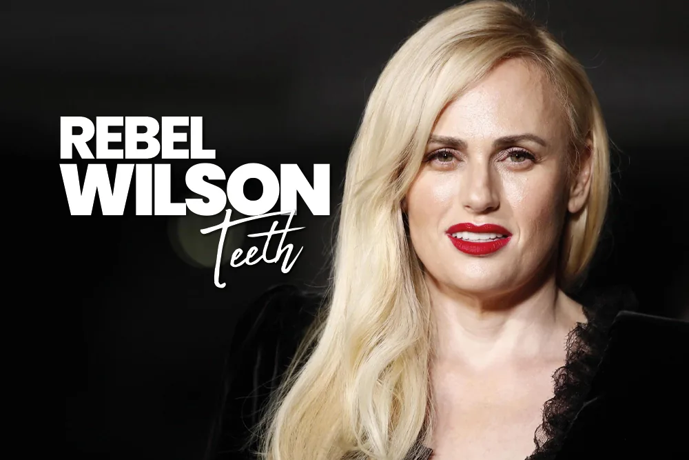 Rebel Wilson Teeth