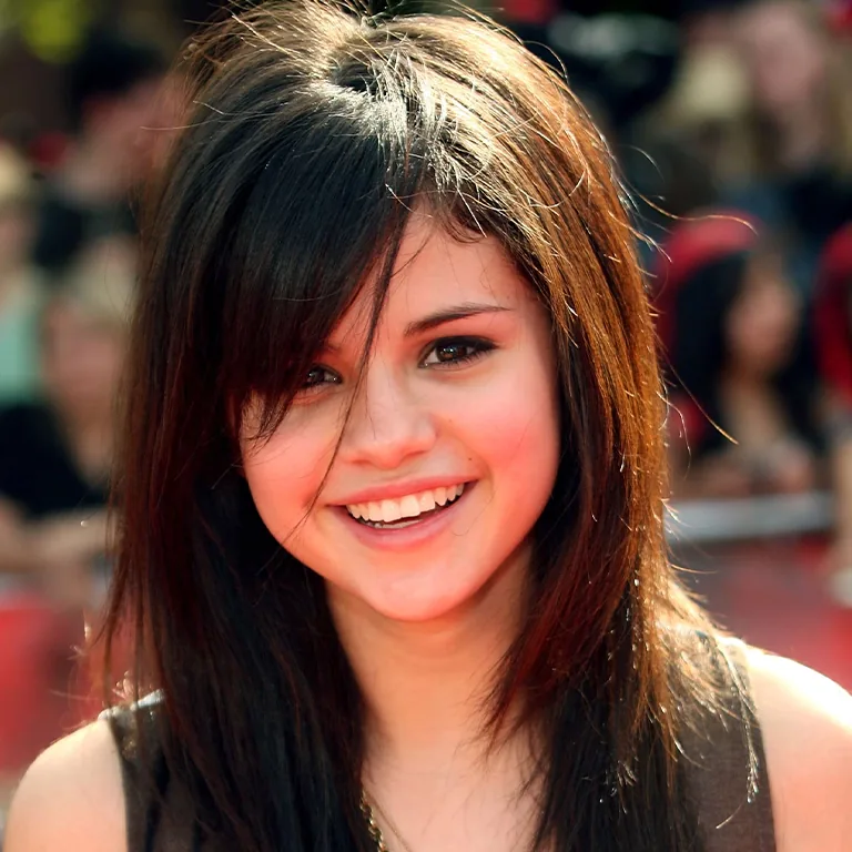 Selena Gomez Before After Teeth
