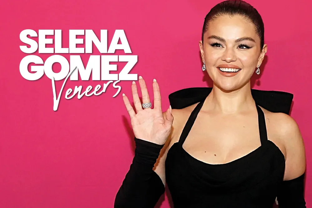 Selena Gomez Teeth