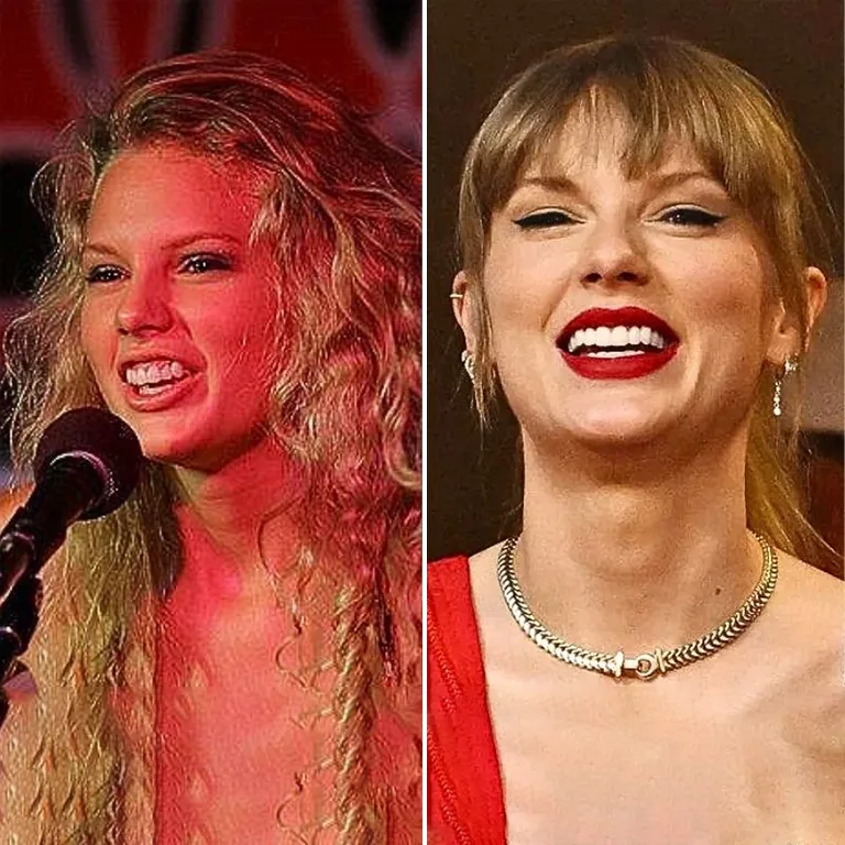 Taylor Swift Dental Aesthetics