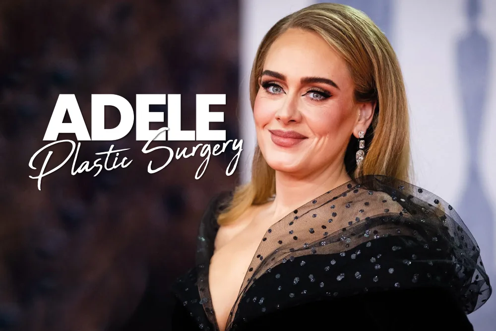 Adele Plastic Surgery