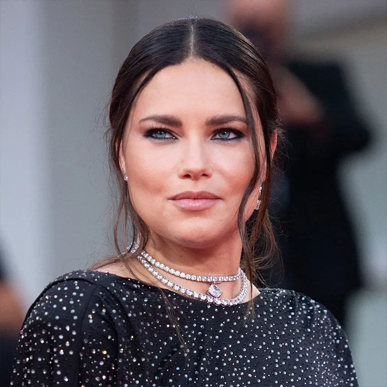 Adriana Lima Cheekbone Surgery
