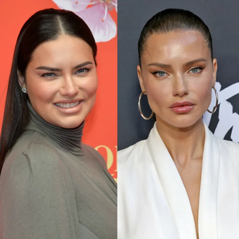 Adriana Lima Facial Aesthetics