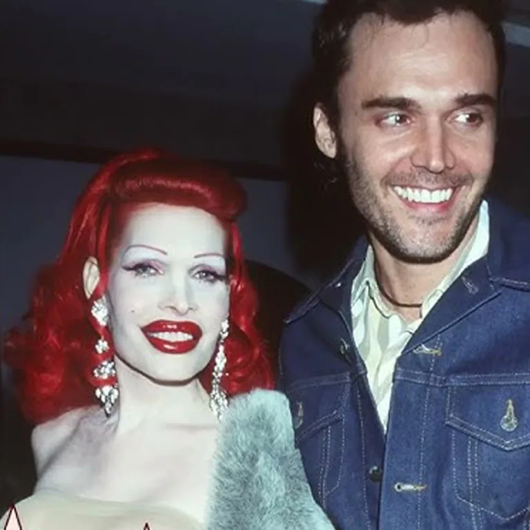 Amanda Lepore Plastic Surgery Before and After