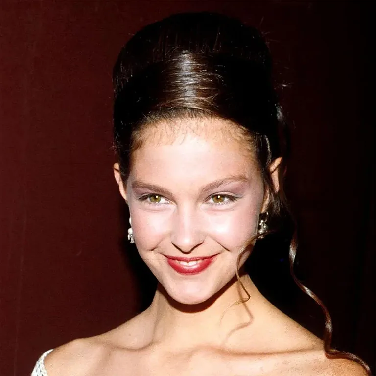 Ashley Judd Plastic Surgery Rumors A Clinical Analysis