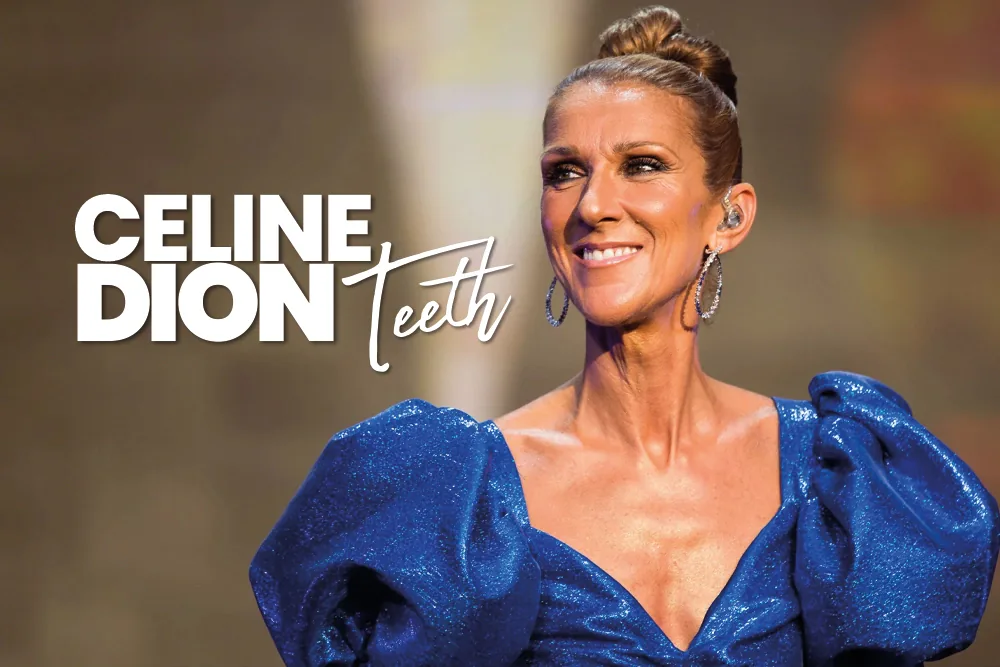 Celine Dion Teeth