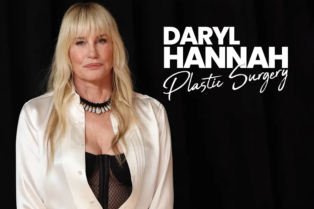 Daryl Hannah Plastic Surgery