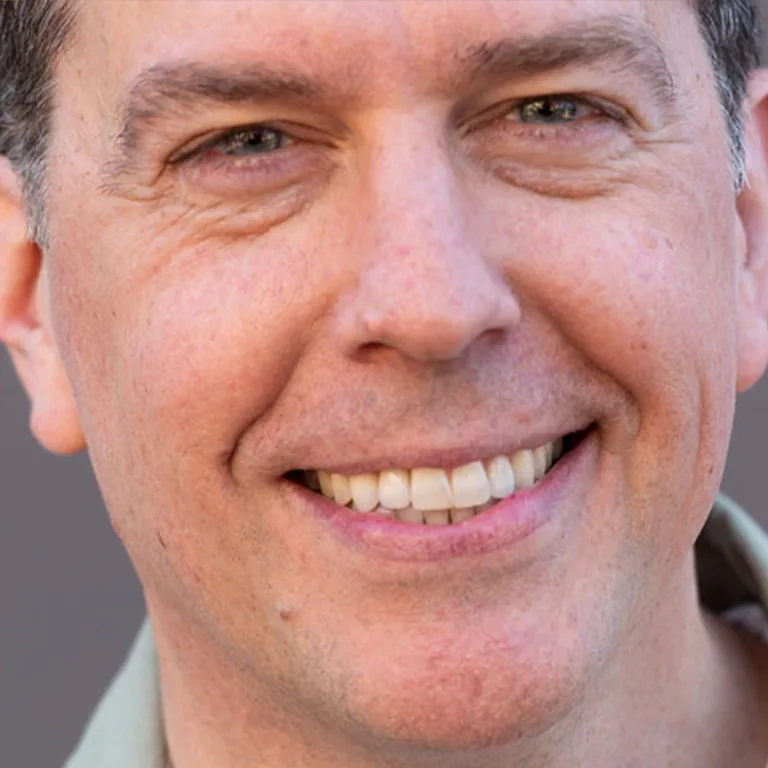 Ed Helms Teeth Whitening