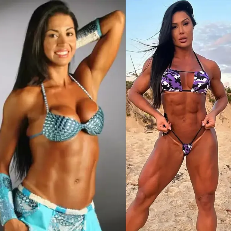 Gracyanne Barbosa Brazilian Butt Lift