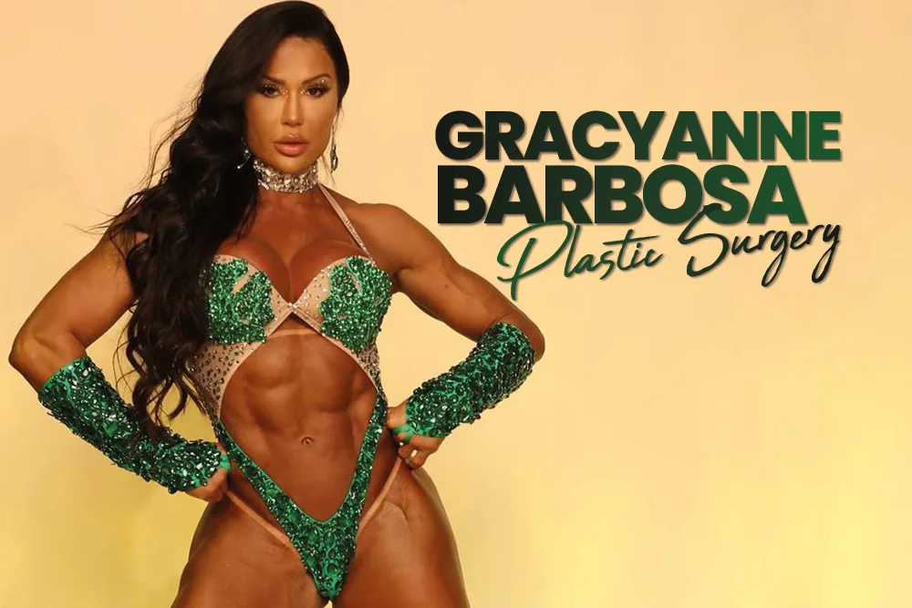 Gracyanne Barbosa Plastic Surgery