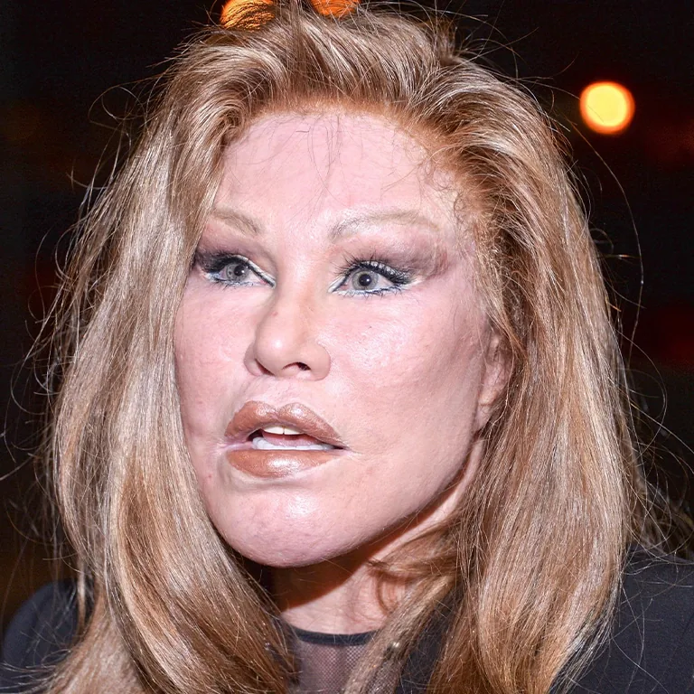 Jocelyn Wildenstein Face Evolution