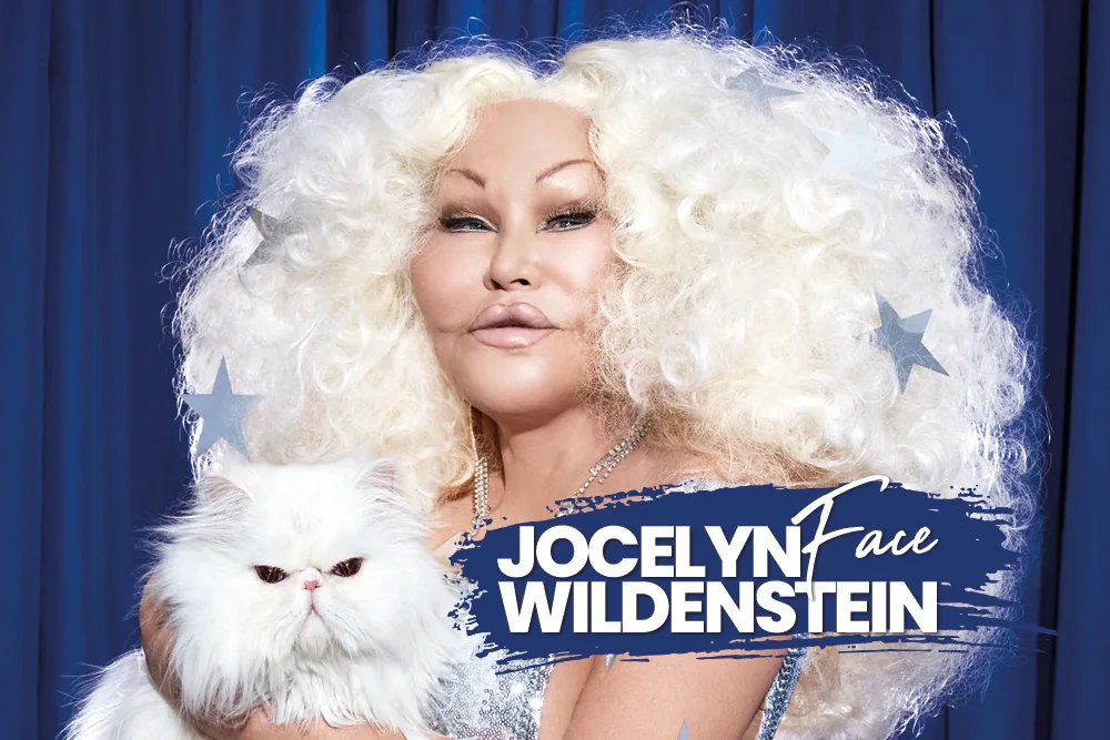 Jocelyn Wildenstein Face