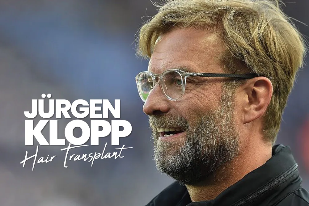 Jürgen Klopp Hair Transplant