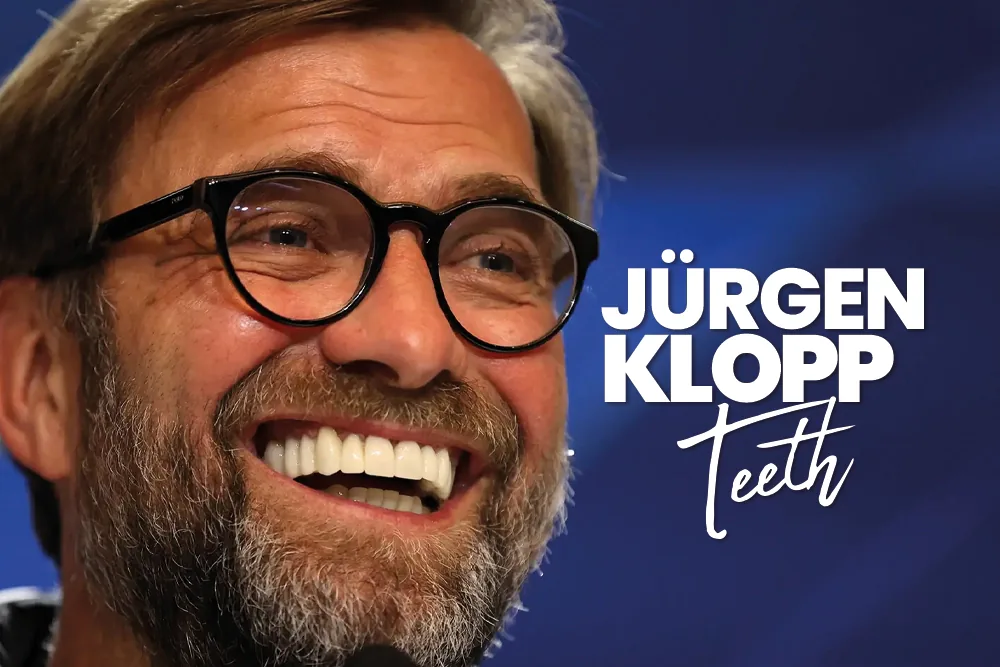 Jürgen Klopp Teeth