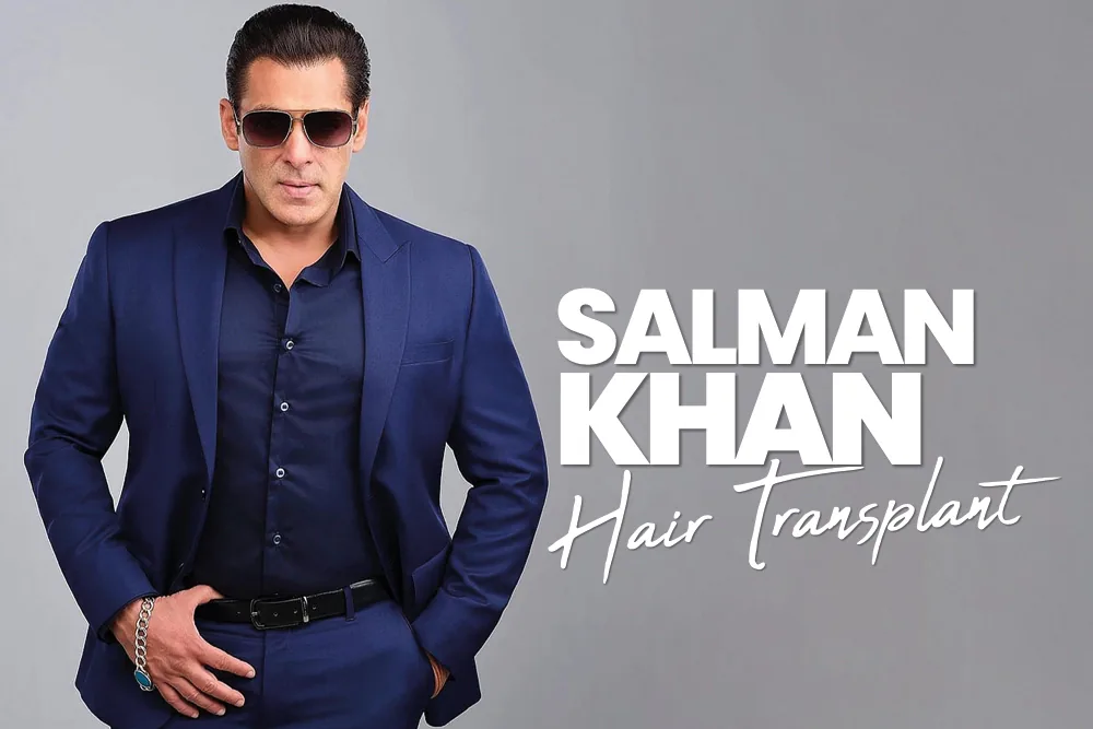 Salman Khan Hair Transplant