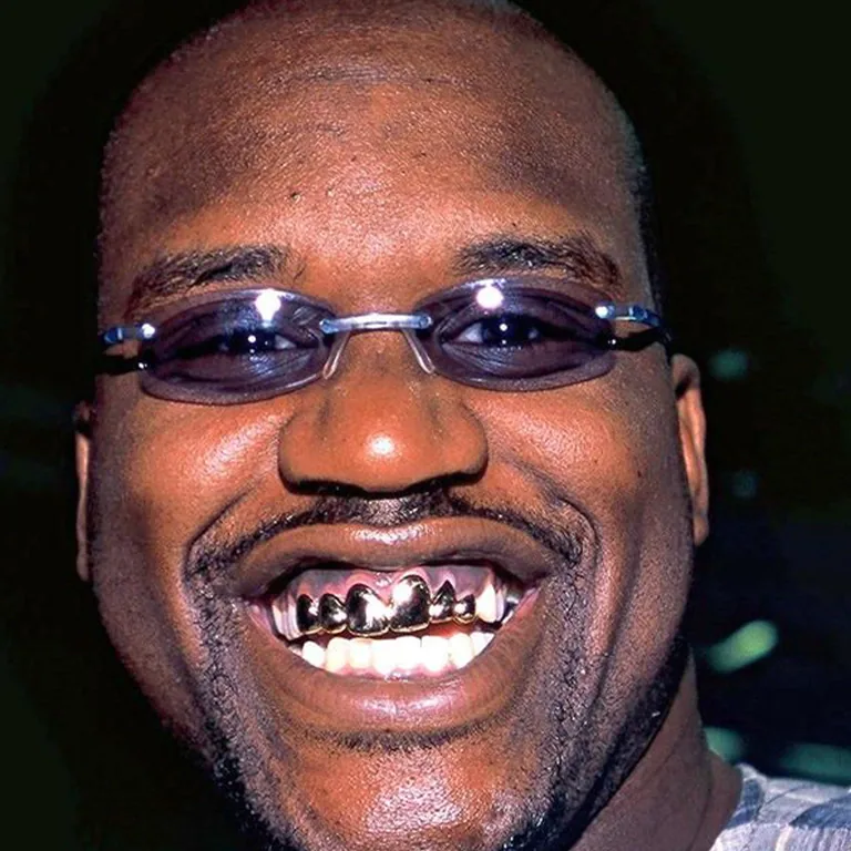 Shaquille O'Neal Teeth Before and After