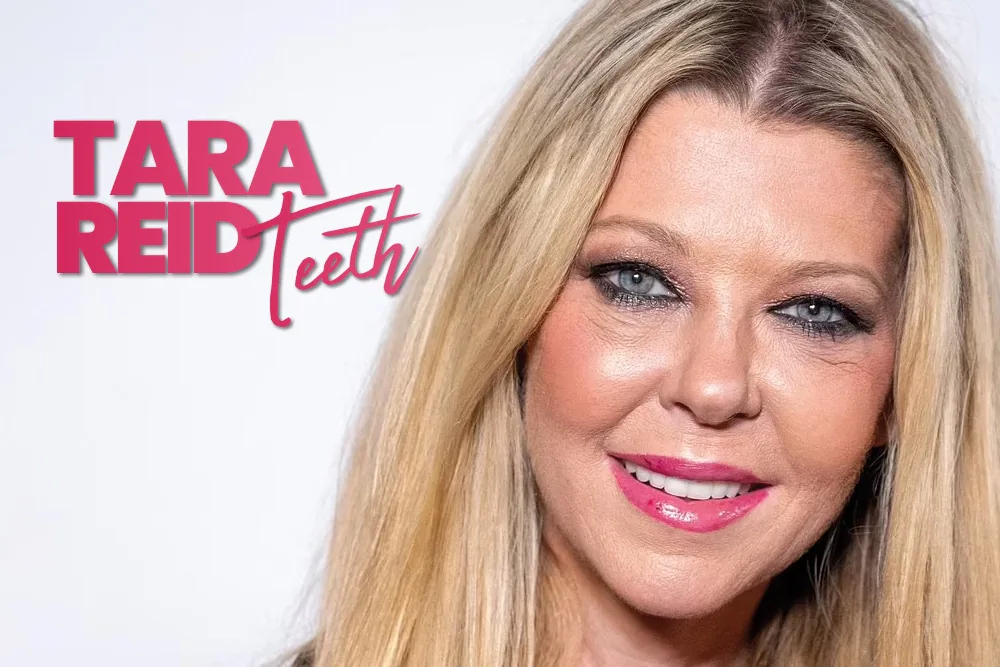 Tara Reid’s Smile Transformation