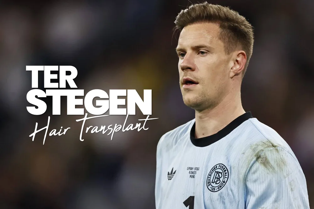 Ter Stegen Hair Transplant