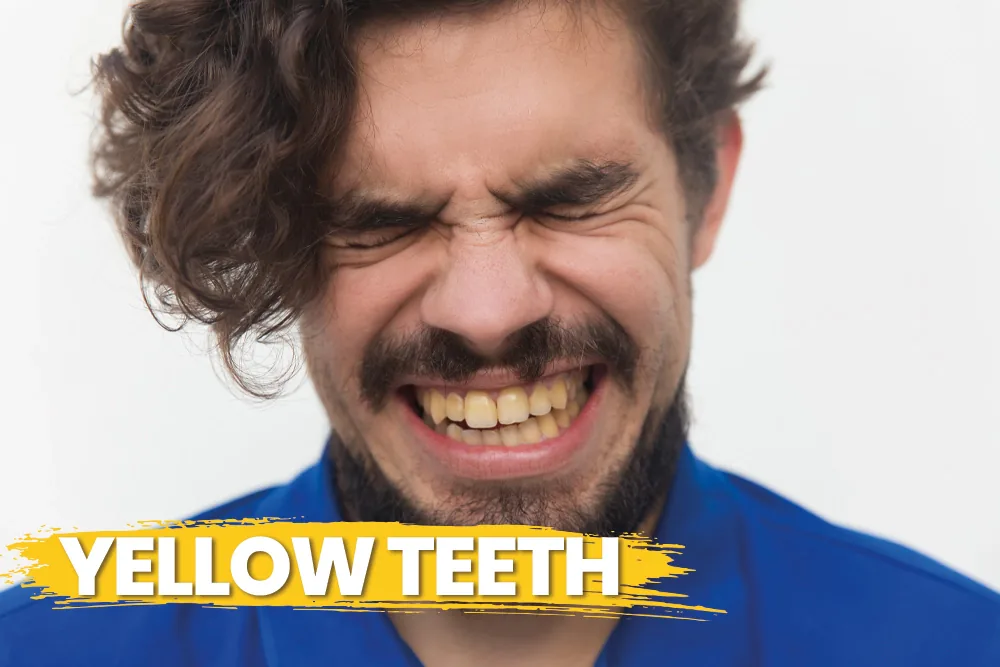 Yellow Teeth