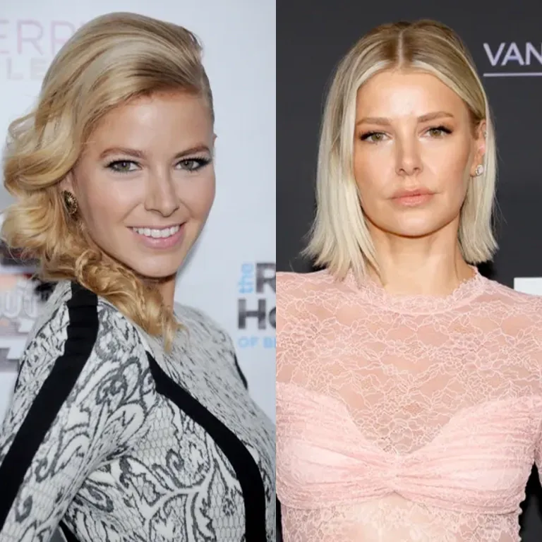 Ariana Madix Plastic Surgery Before and After