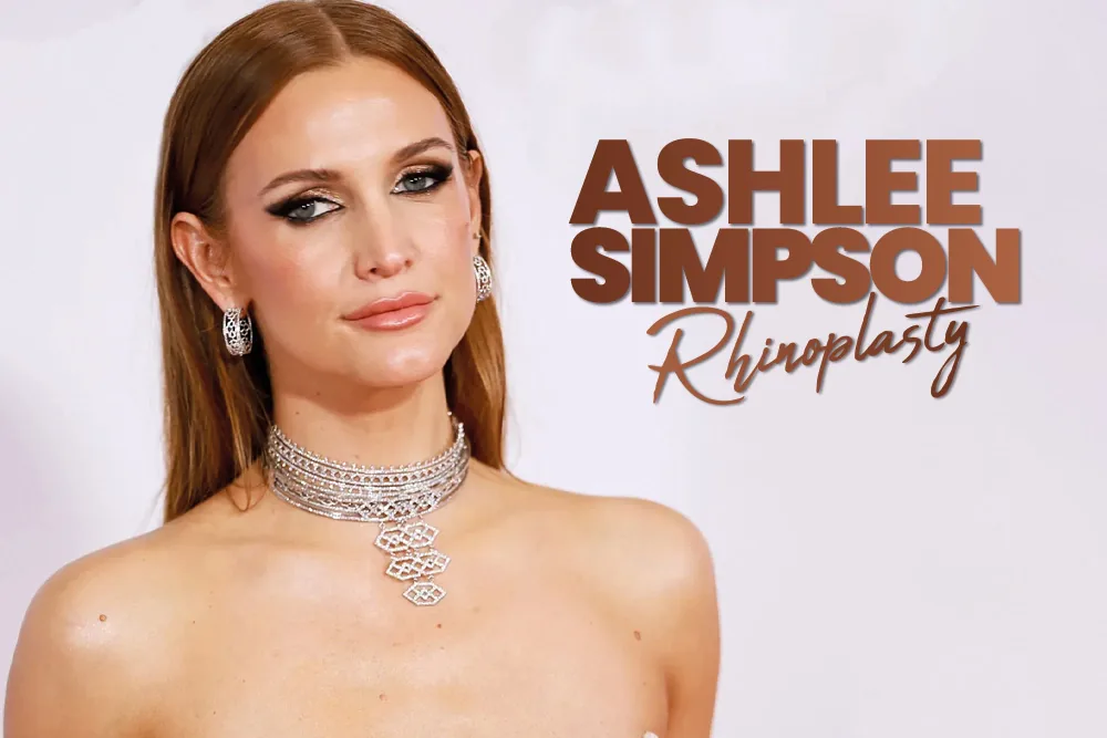 Ashlee Simpson Rhinoplasty
