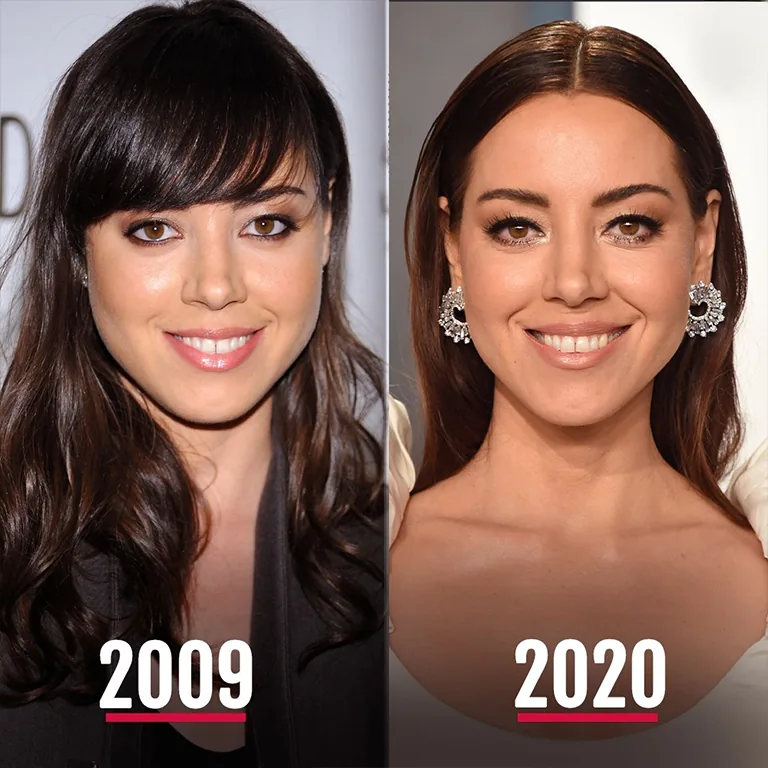 Aubrey Plaza Plastic Surgery Before and After