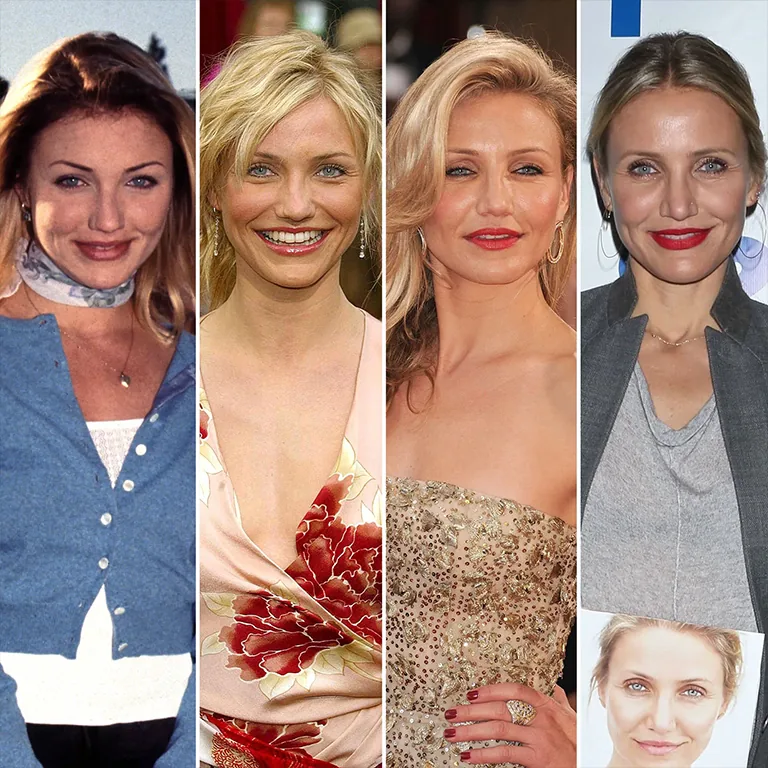 Cameron Diaz Rhinoplasty The Full Story