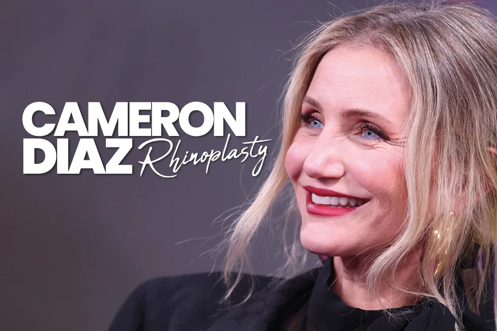 Cameron Diaz Rhinoplasty