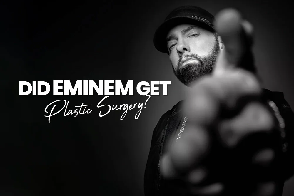 Did Eminem Get Plastic Surgery?